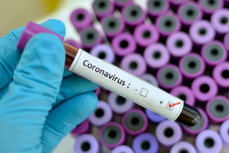 Azərbaycanda bugün koronavirusa yoluxma sayında REKORD