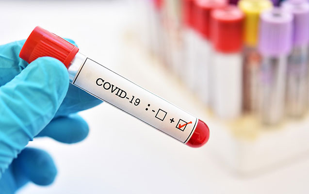 Azərbaycanda daha 167 nəfərdə koronavirus aşkarlandı