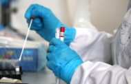 Azərbaycanda indiyədək 2 768 149 koronavirus testi aparılıb