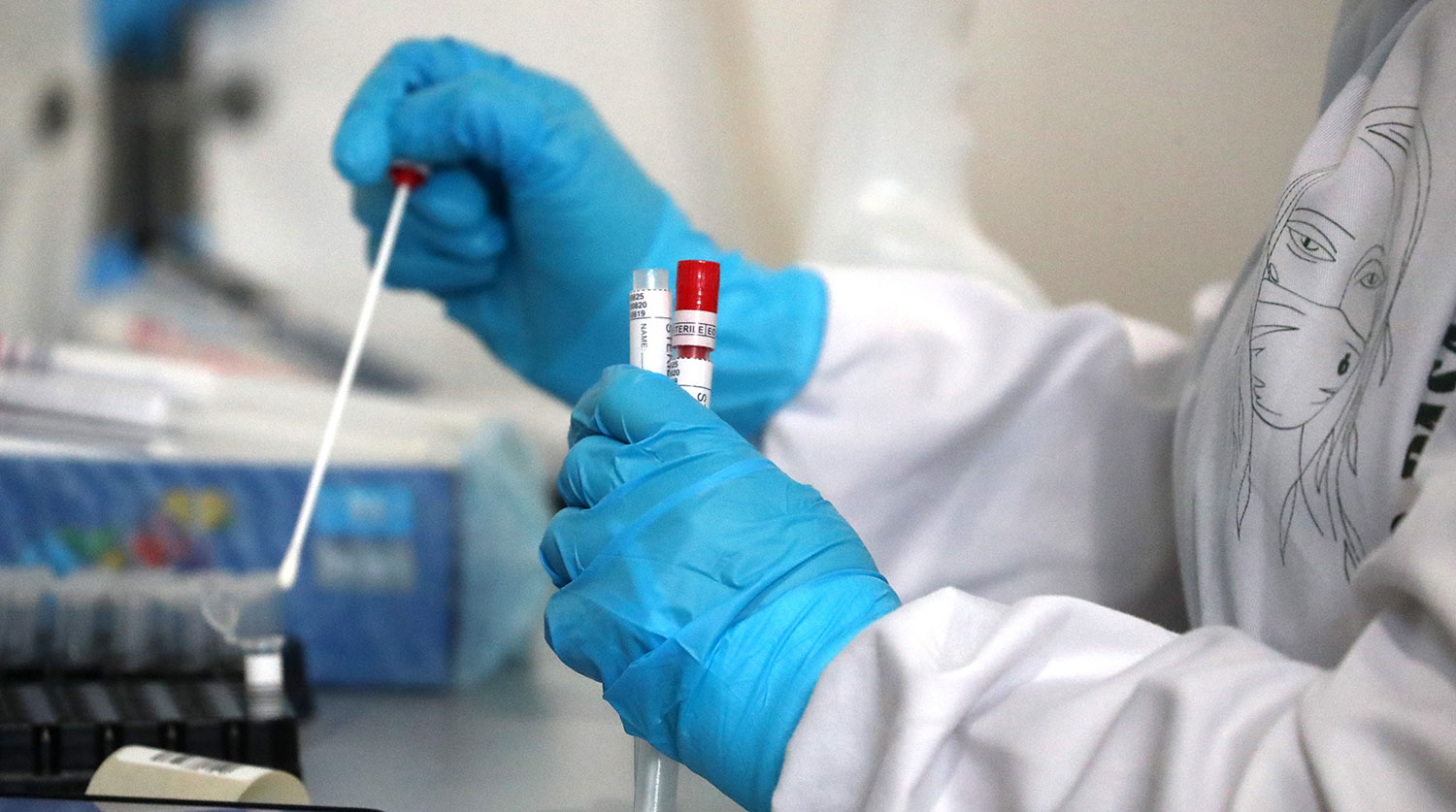 Azərbaycanda indiyədək 2 768 149 koronavirus testi aparılıb