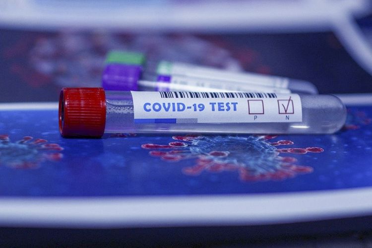 Azərbaycanda indiyədək 2 653 375 koronavirus testi aparılıb