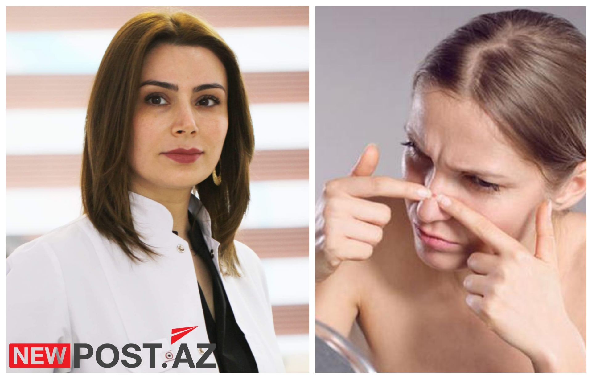 “Qara nöqtələrdən necə azad olaq?” – Həkim-kosmetoloq Sevinc Əliyevanın özəl AÇIQLAMASI