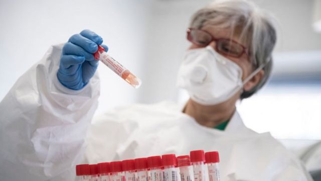 Azərbaycanda koronavirusa yoluxanların sayı kəskin artdı