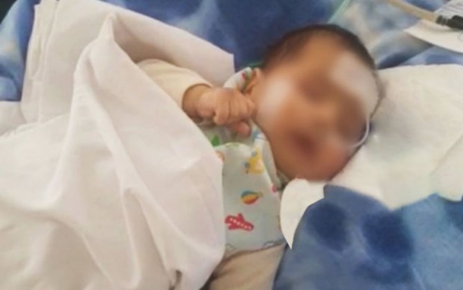 Bakıda bir həftə komada qalan üçaylıq körpənin həyatı xilas edildi